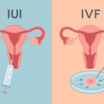 تفاوت IUI و IVF برای درمان ناباروری زوجین